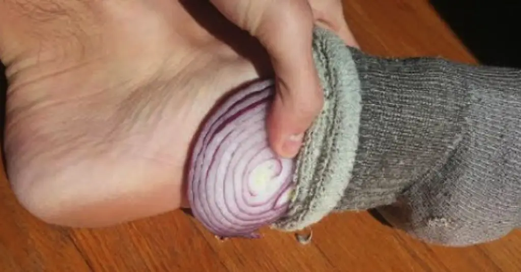 This is What Happens When You Put Cut Up Onions in Your ... This is What Happens When You Put Cut Up Onions in Your ...